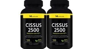 시서스 일단 한번 확인해요! 필수품 구매가이드