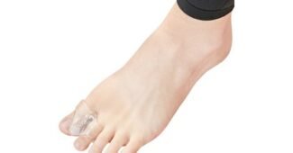 무지외반증교정기 후회없는 비교 빈틈없는비교